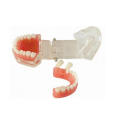 TM-A15 Removable Standard Model of 28PCS Teeth
